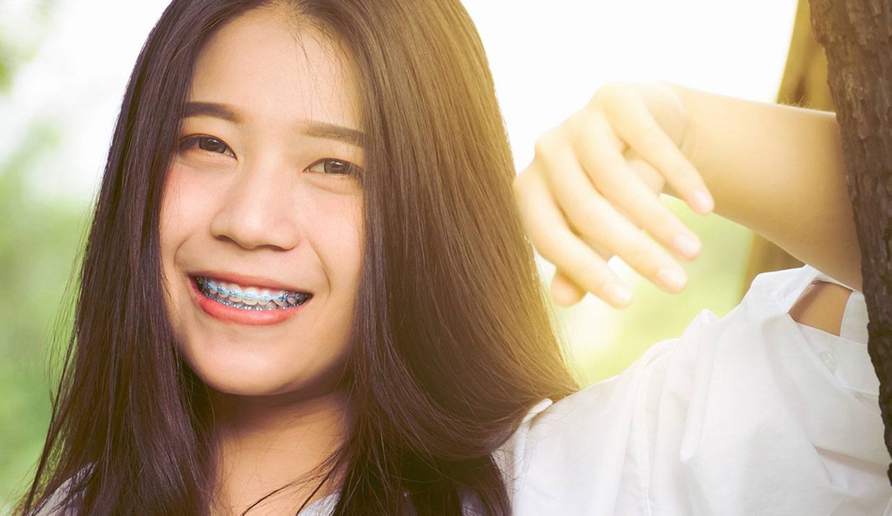 Do you find teeth braces attractive? : r/Thailand